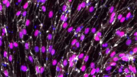 Stem Cell Advance Brings Bioengineered Arteries Closer to Reality