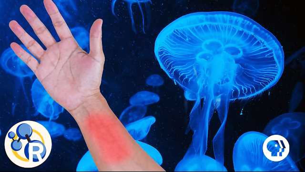 Should You Pee on Jellyfish Stings?