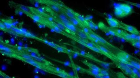 Leading Lab Uses Skeletal Muscle Differentiation Kit to Study Duchenne Myopathy