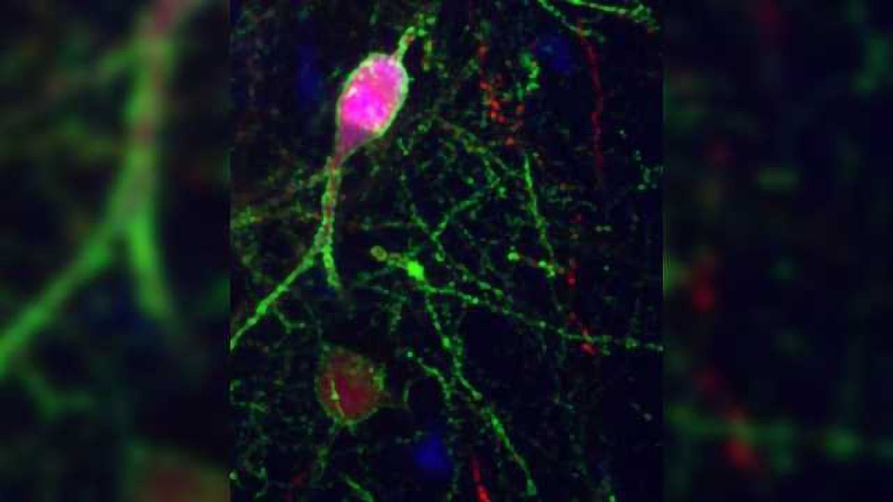 Molecular Mechanism That Enable Neuronal Connections to Change With Development Discovered