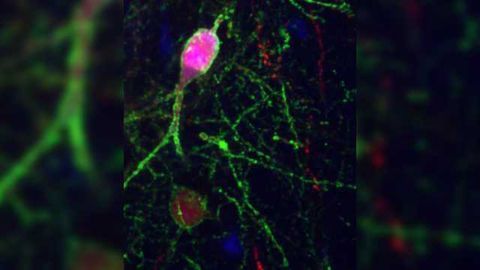 Molecular Mechanism That Enable Neuronal Connections to Change With Development Discovered