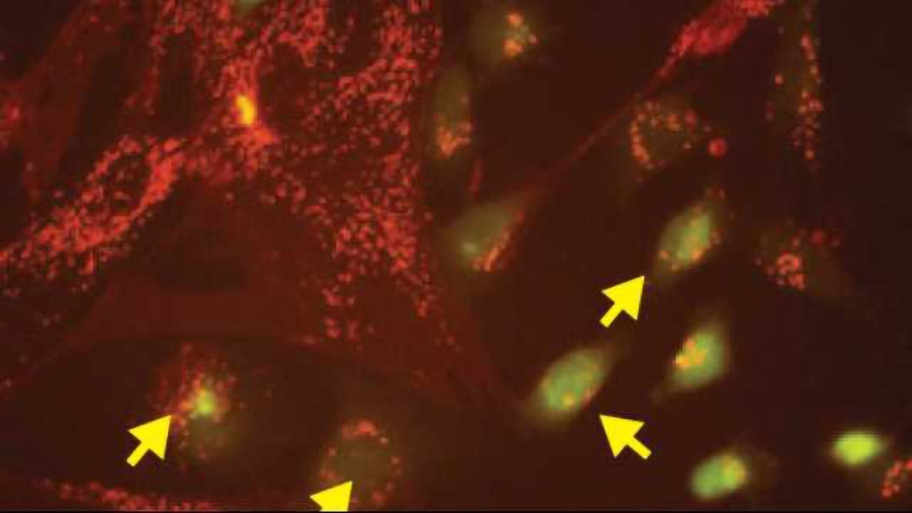 Cancer Cells Force Normal Cells to Act Like Viruses, Helping Tumors Spread