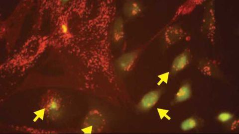 Cancer Cells Force Normal Cells to Act Like Viruses, Helping Tumors Spread