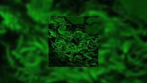 Eye Microbiome Helps Protect Mice From Pathogens