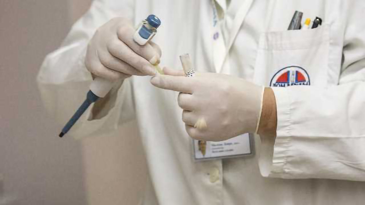 Candidate Metabolomic Network for Bladder Cancer Diagnostics Identified