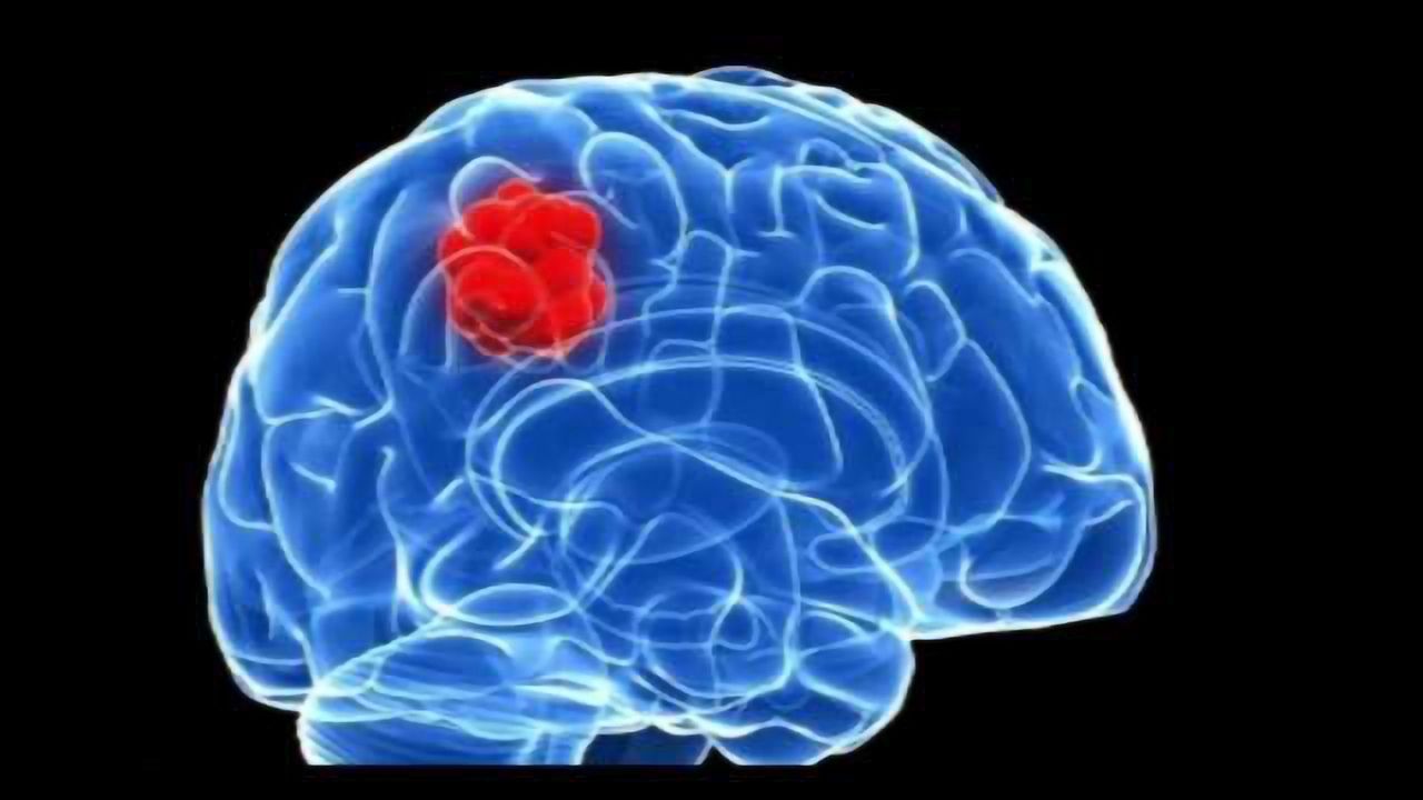 Changing microRNA's Presence in Glioblastoma Cells Could Change the Tumor's Subtype