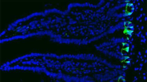 Understanding How the Intestine Regenerates