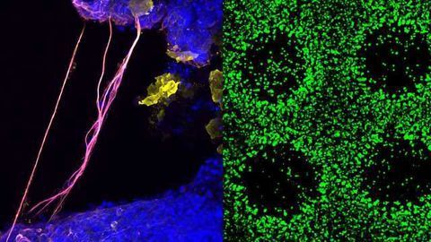 Human Pluripotent Stem Cells Successfully 3D Printed