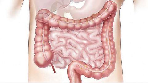 The Role of Secretory Autophagy in Intestinal Defense