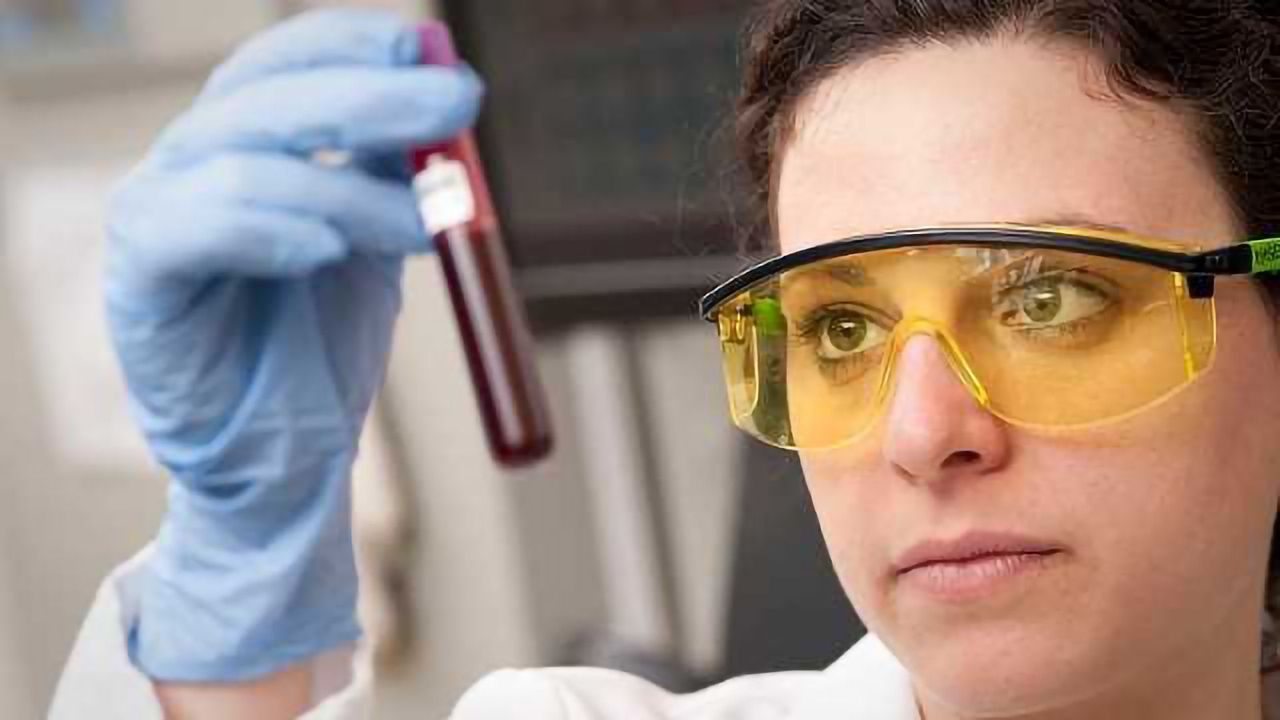 ctDNA as a Blood-based Biomarker for Immunotherapy Response