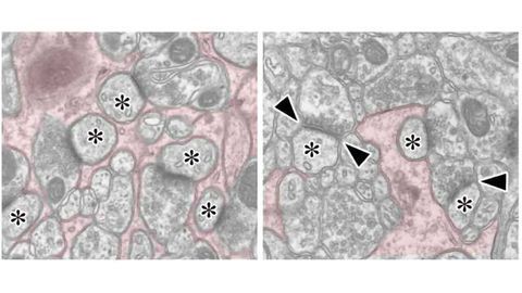 Bergmann Glia Molecule Essential for Correct Neuronal Wiring in the Cerebellum