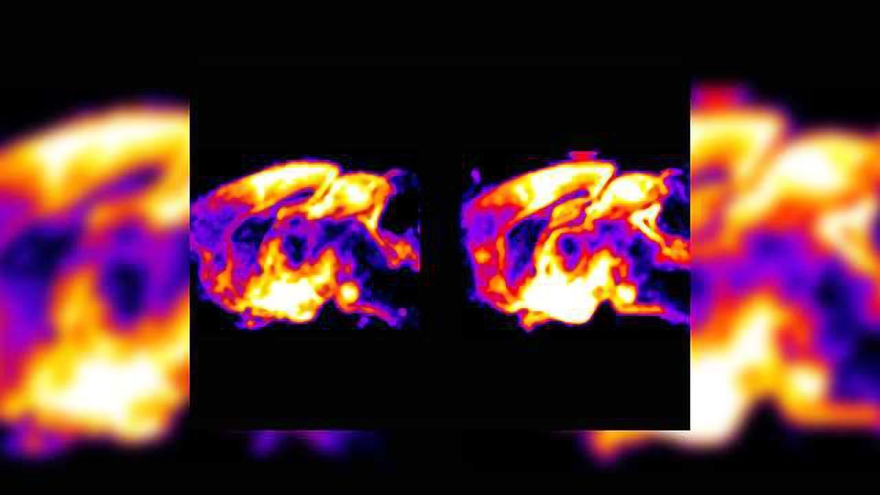 Brainstem Control of Feeding Behavior