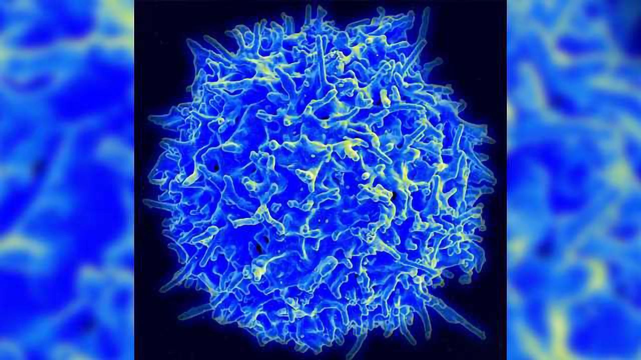 T-cells Implicated in Parkinson's Disease