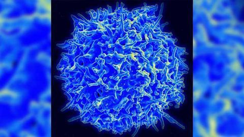 T-cells Implicated in Parkinson's Disease