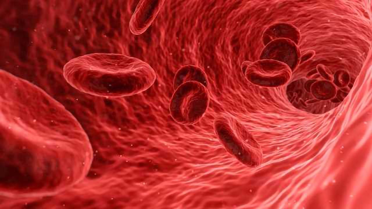 A Blood-based Screening Test for Alzheimer's