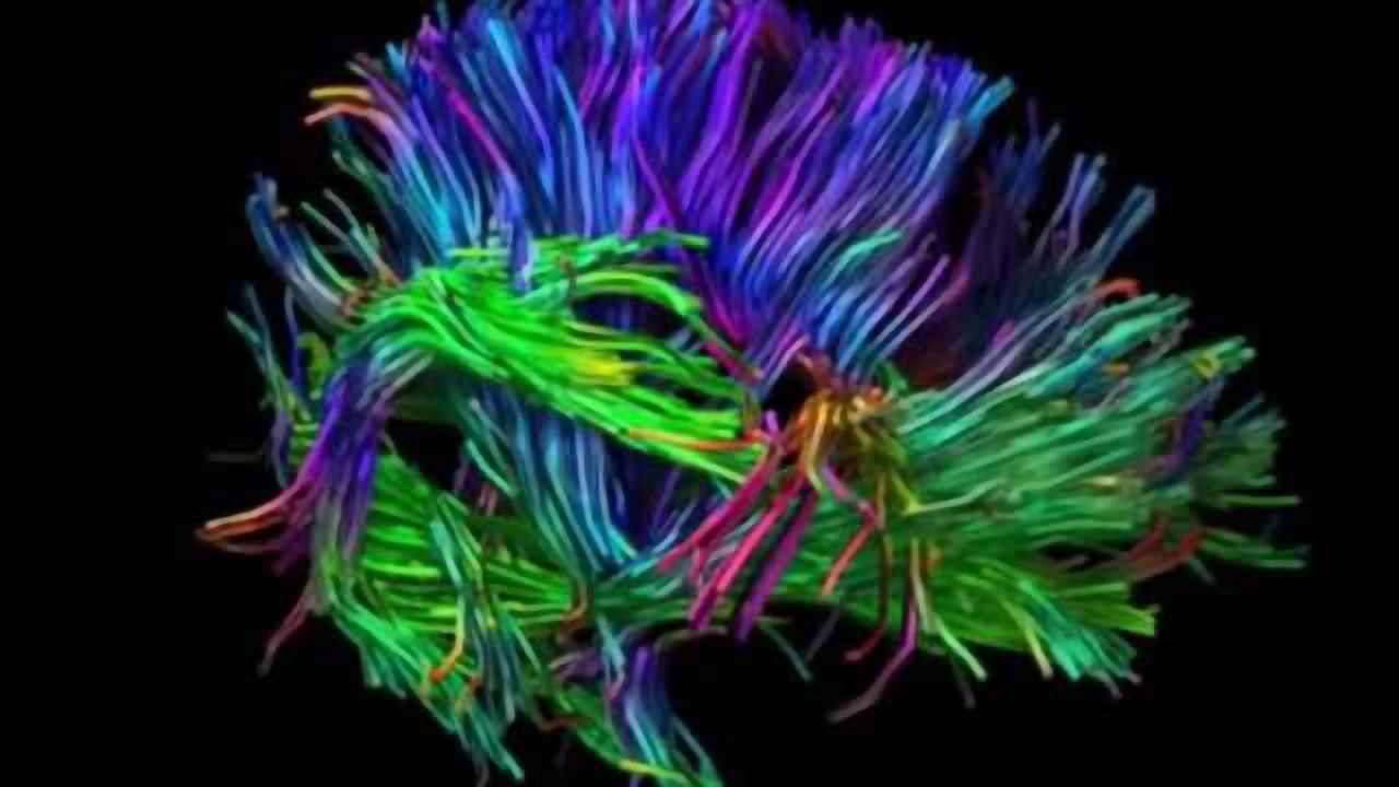 Principle Diffusion Direction Imaging Method Explained
