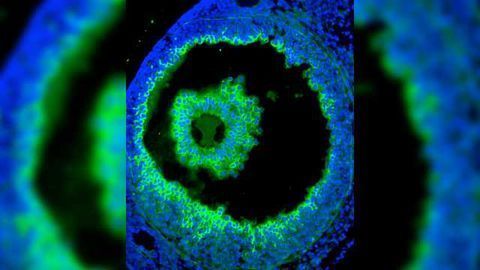 AMSBIO Launches ELISA-like Assay for Hyaluronic Acid