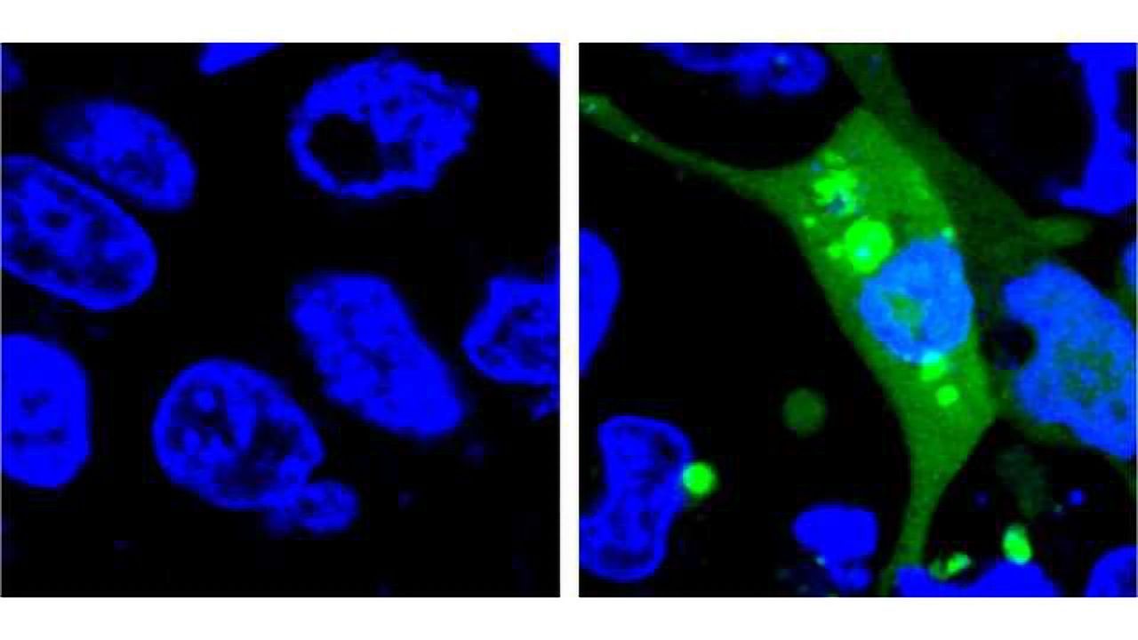 Drug Safety: More sensitive sensor developed