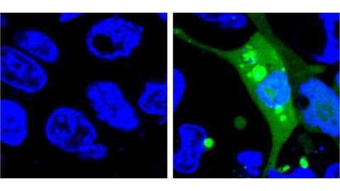 Drug Safety: More sensitive sensor developed