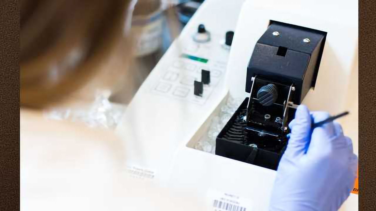 Necroptosis Pathway Implicated in Alzheimer's Disease