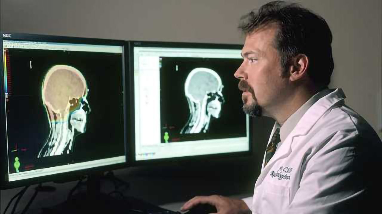 Genetic Basis of Radiation-induced Brain Cancer Identified