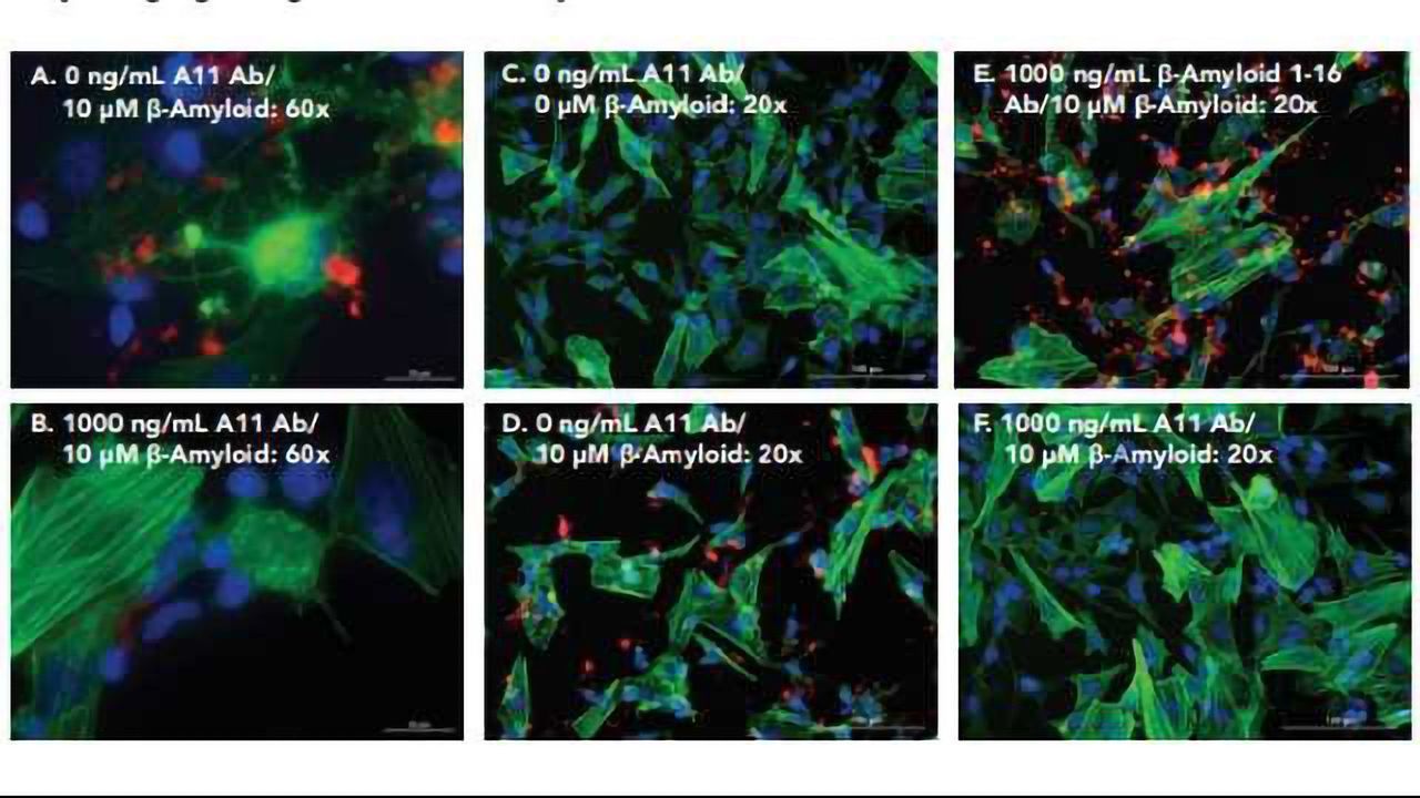 Analysis of the Effect of Aggregated β-Amyloid on Cellular Signaling Pathways Critical for Memory in Alzheimer’s Disease