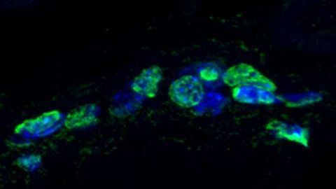 Ageing is Exacerbated by Alterations of Stem Cell Circadian Rhythm