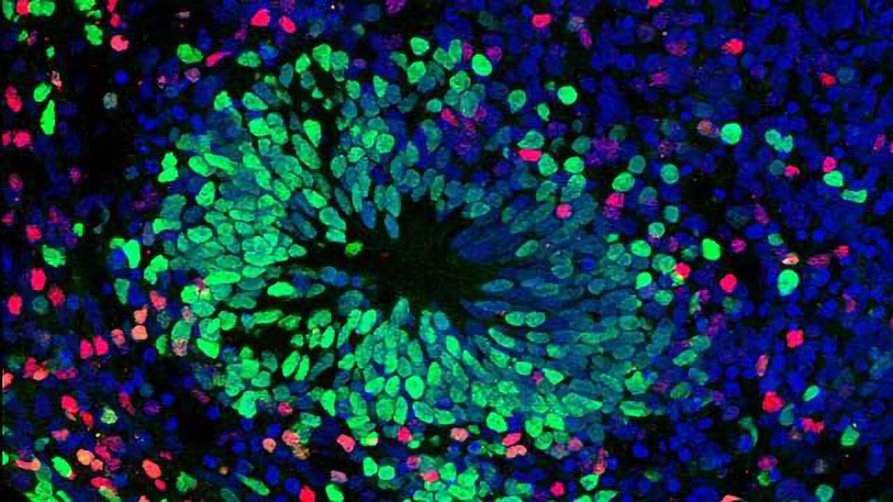 Brain-in-a-Dish Models Neuroinflammation