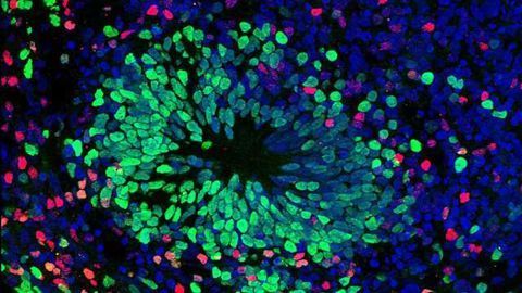 Brain-in-a-Dish Models Neuroinflammation