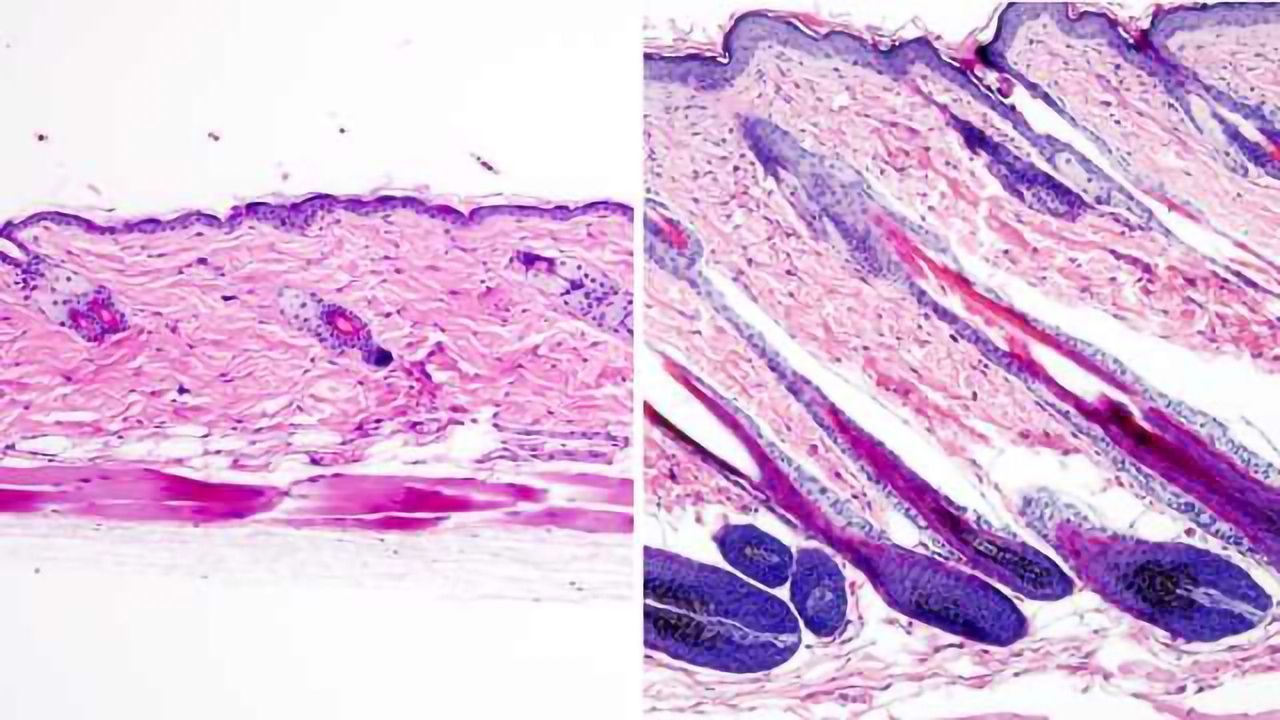 Activating Stem Cells to Make Hair Grow