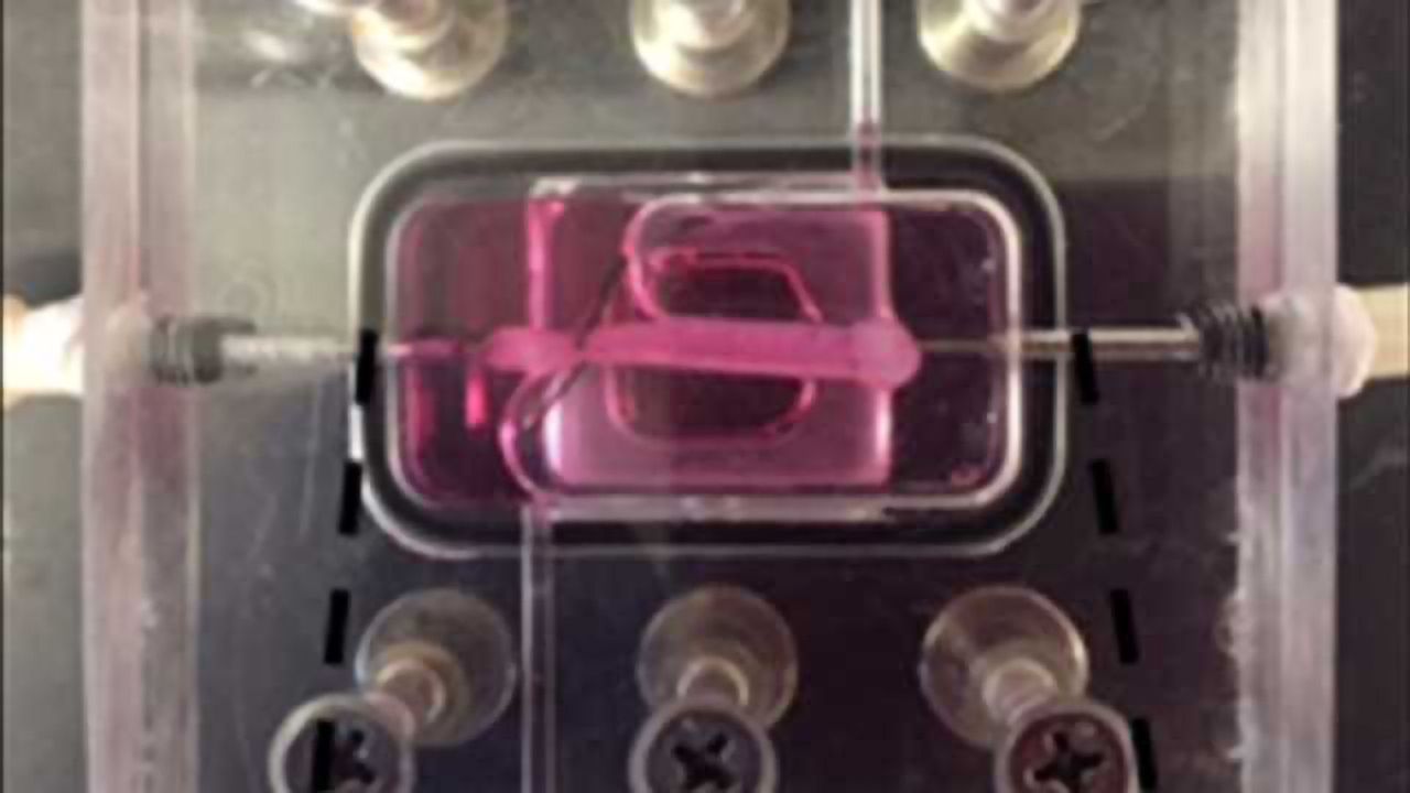 Artificial Blood Vessels Mimic Rare Accelerated Aging Disease