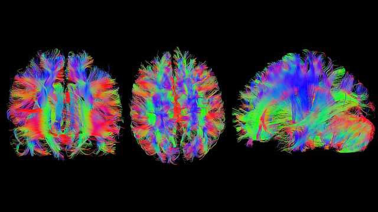 Beautiful Brain Images