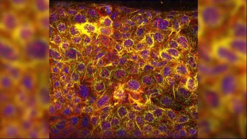MIMETAS Develops Novel Gut-On-A-Chip Technology in Collaboration with Pharmaceutical Company