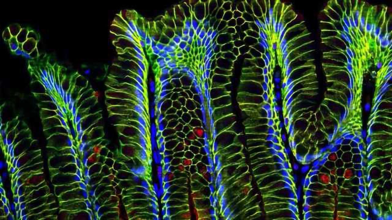 Are Stem Cells the Link Between Bacteria and Cancer?