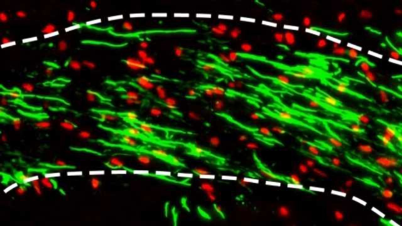 Test Successfully Identifies Which Research Results in Mice Will Help Humans With MS