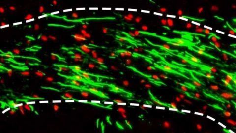Test Successfully Identifies Which Research Results in Mice Will Help Humans With MS