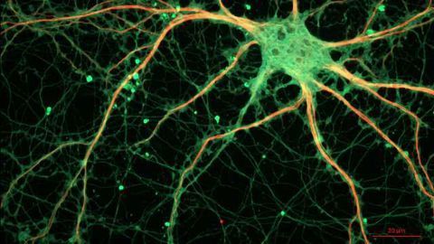 Researchers Make Surprising Discovery About How Neurons Talk to Each Other
