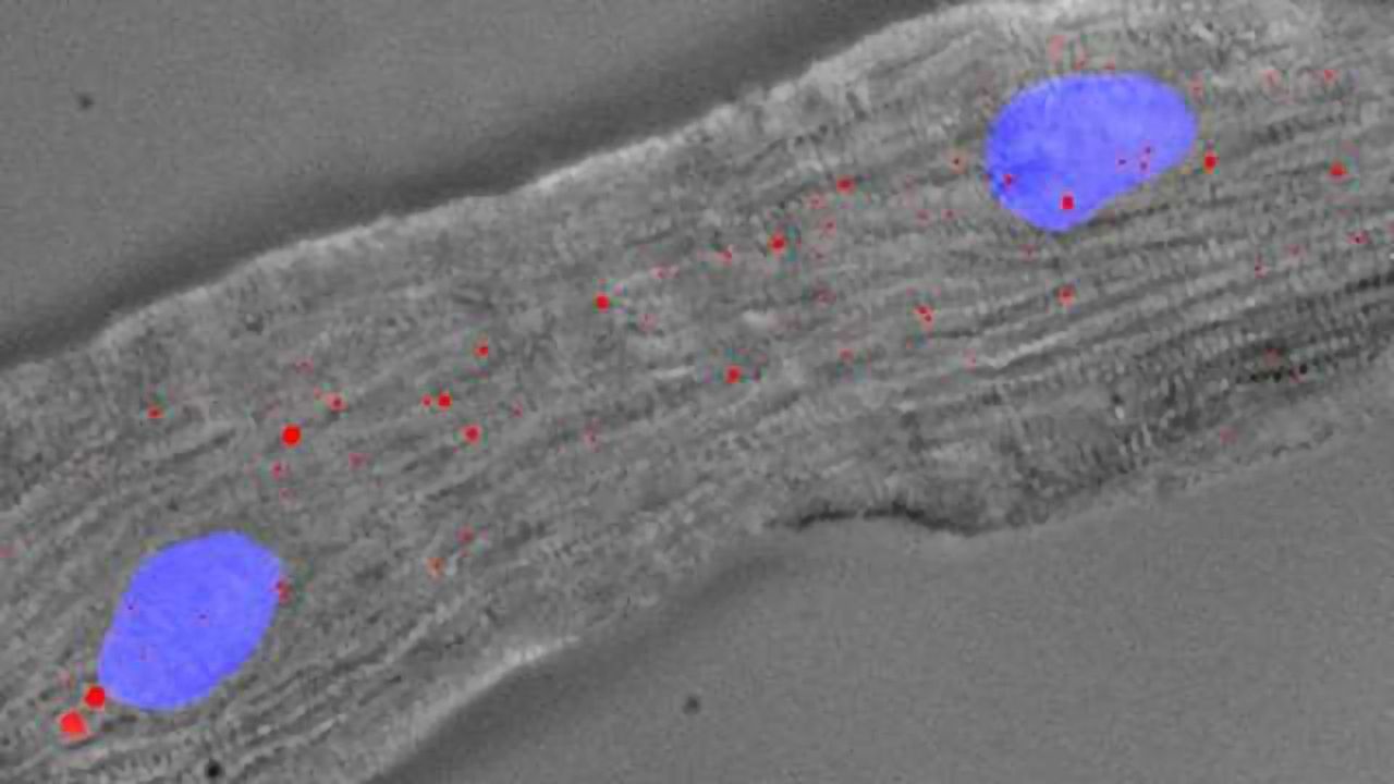 Novel RNA Found to Control Ability of Heart Cells to Undergo Repair