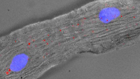 Novel RNA Found to Control Ability of Heart Cells to Undergo Repair
