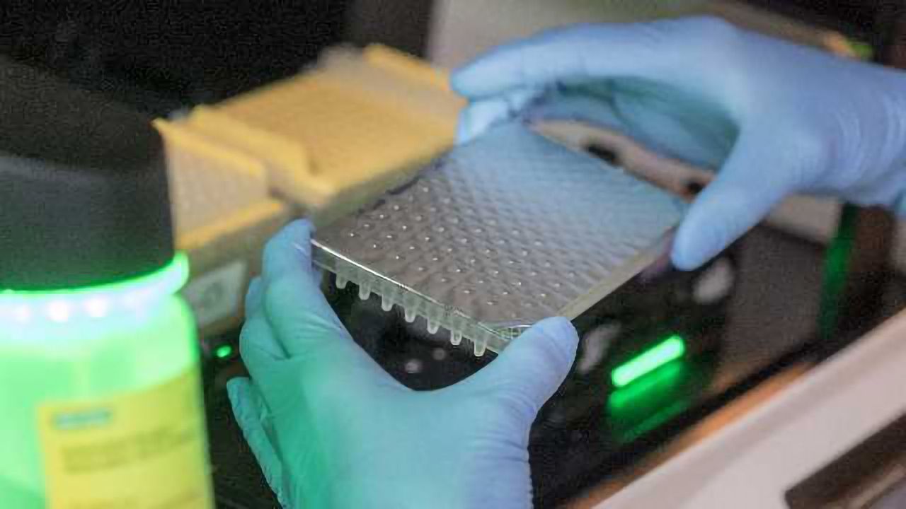 Blood Test Predicts Prostate Tumor Resistance