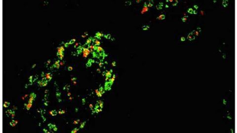 New Tools Detect Granulin Inside Cells for First Time