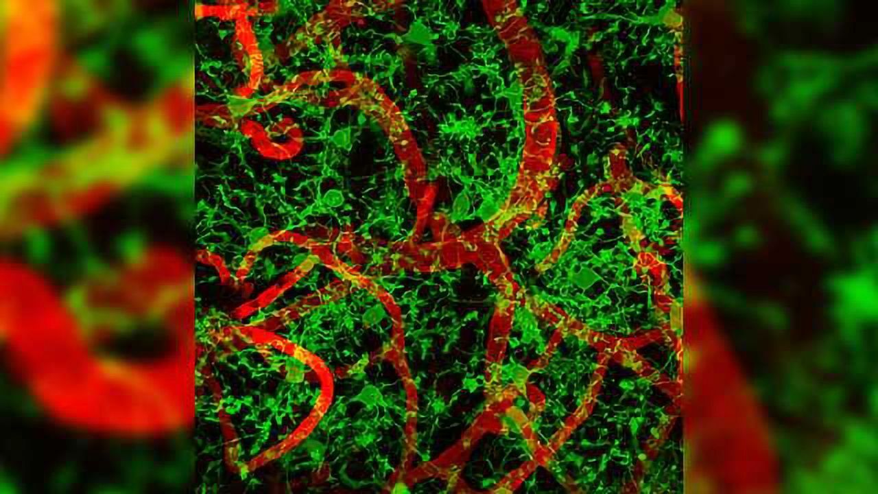 Leprosy Bacteria Hijack Immune System Macrophages