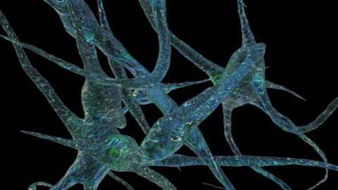 RNA Transcripts in Blood Could Help Detect Alzheimer's Disease Earlier