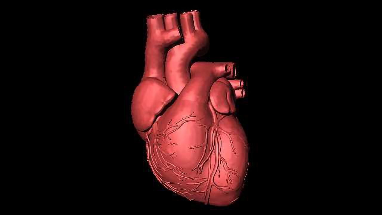 Lasers Used to Detect Risk of Heart Attack and Stroke