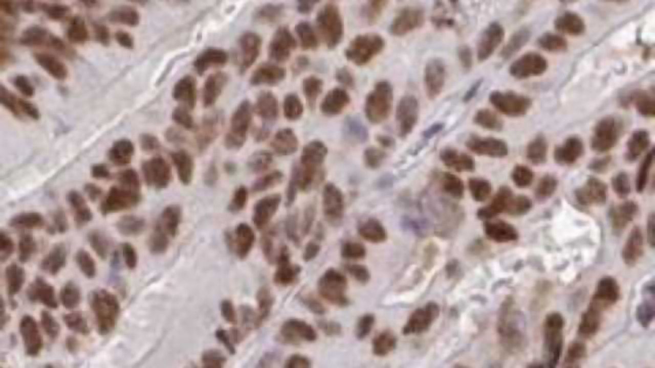 New Pathology Atlas Launched