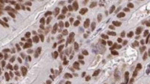 New Pathology Atlas Launched