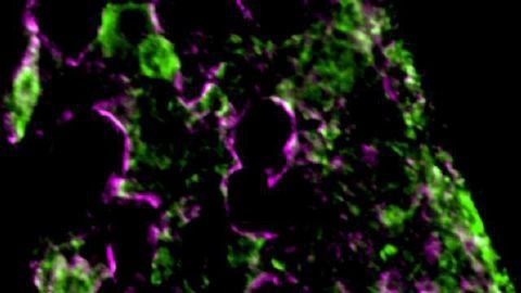 Bone Marrow Protein May Be Target for Improving Stem Cell Transplants