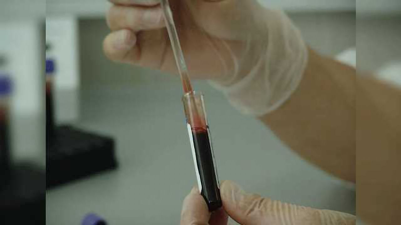 Drug May Protect Against Infertility in Women Undergoing Cancer Treatments