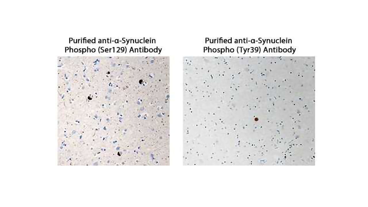 Image α-Synuclein Aggregration