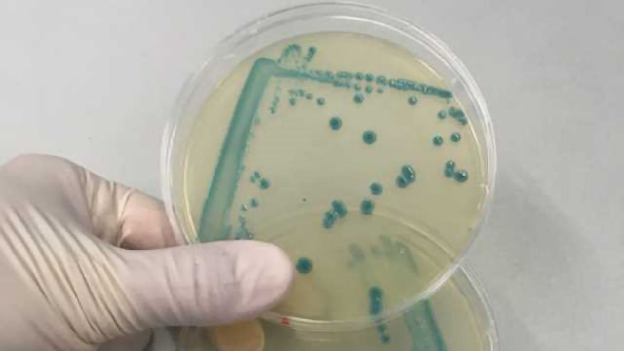 Why Some Listeria Strains Survive Good Food Hygiene Standards